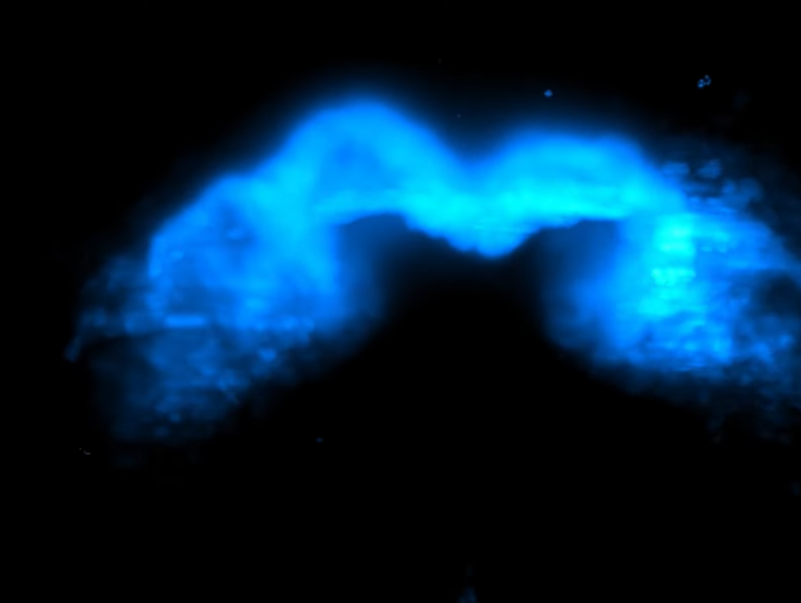 «Συναρπαστικό βίντεο: Η μαγευτική στιγμή που σχηματίζεται η καρδιά σε έμβρυο»