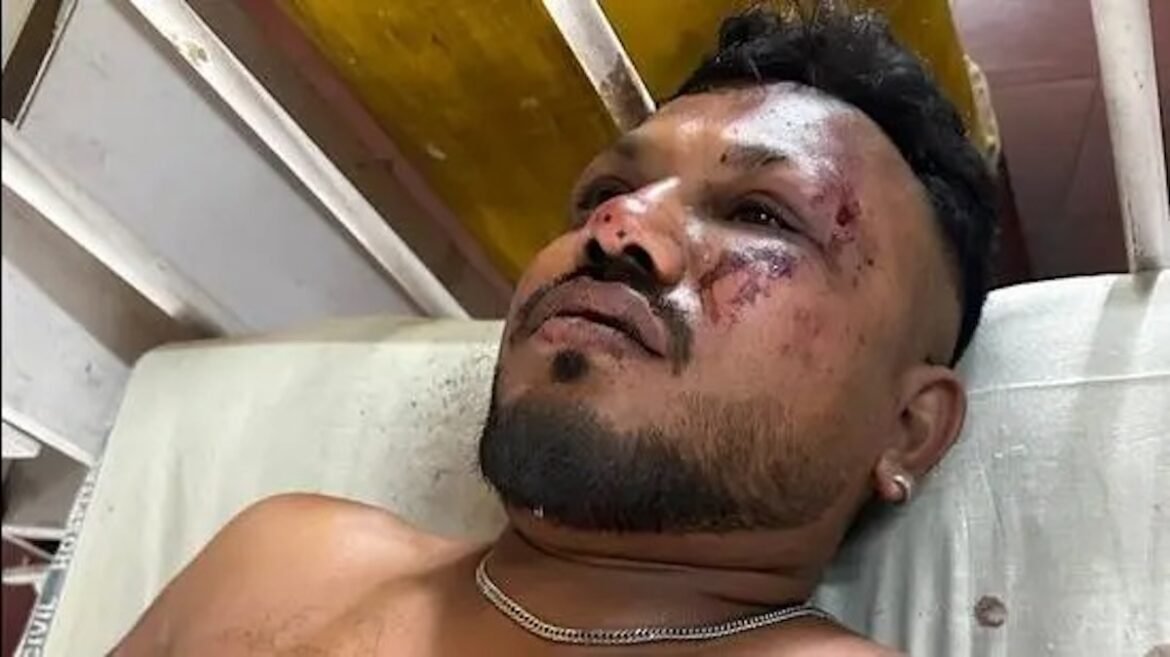 Ινδία: Πώς γλύτωσε από θαύμα ο τυχερός επιβάτης της θέσης 11Α – Δείτε βίντεο να περπατά λίγο μετά το δυστύχημα