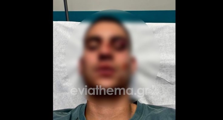 Σοκ στη Χαλκίδα: Επιτέθηκε και ξυλοκόπησε 19χρονο για ένα «like» στα social media