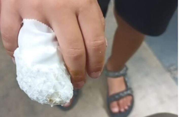 Δράμα: 8χρονος τραυματίστηκε σε παιδική χαρά  – «Δεν σταματούσε να κλαίει, ο πόνος ήταν πολύ έντονος»