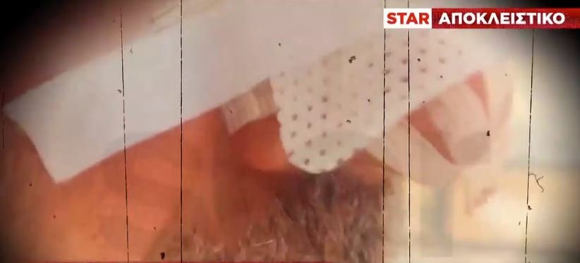 Τρόμος στην Ηλιούπολη: Απόπειρα ληστείας και άγρια επίθεση με σφυρί – «Έχω σπασμένη μύτη, θα μπορούσε να με