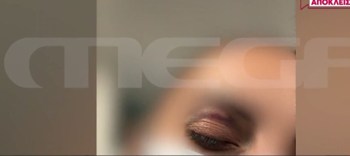 Ενδοοικογενειακή βία: Συγκλονιστική μαρτυρία θύματος – «Έβαλε τον σύρτη στην πόρτα, δεν με άφηνε να φύγω» –